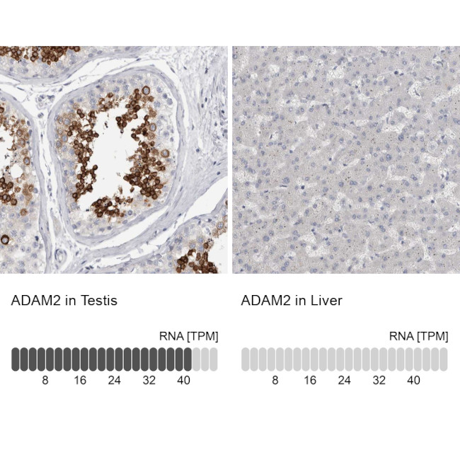 ADAM2 Antibody in Immunohistochemistry (IHC)