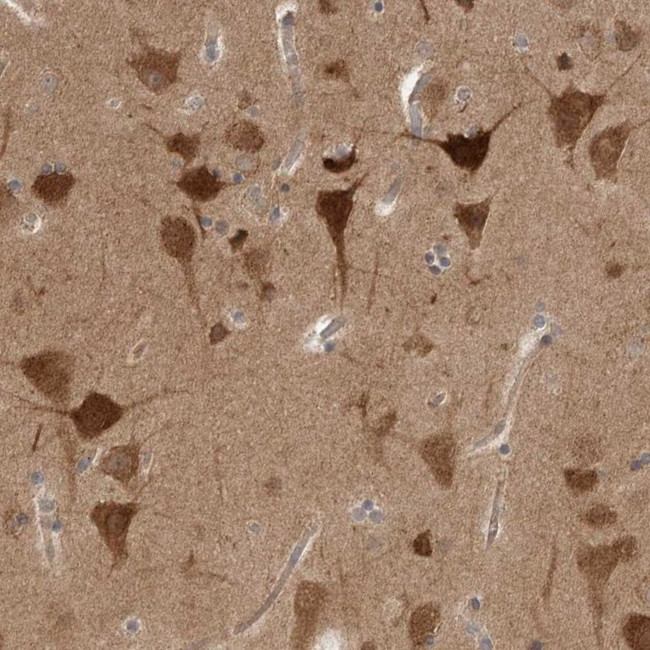 PRKAR1B Antibody in Immunohistochemistry (IHC)