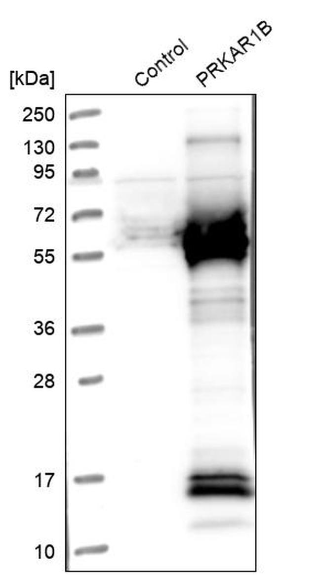 PRKAR1B Antibody in Western Blot (WB)