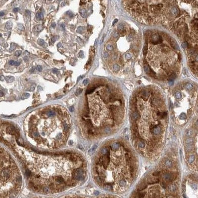 TRMT61B Antibody in Immunohistochemistry (IHC)