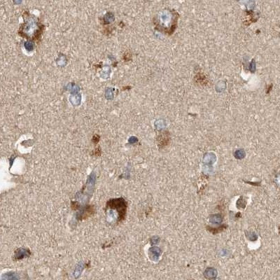 TRMT61B Antibody in Immunohistochemistry (IHC)