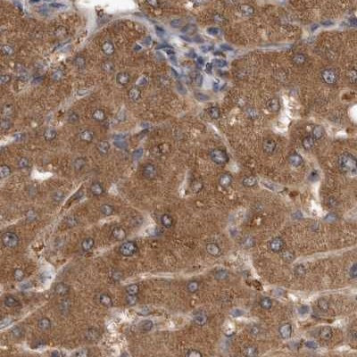 TRMT61B Antibody in Immunohistochemistry (IHC)