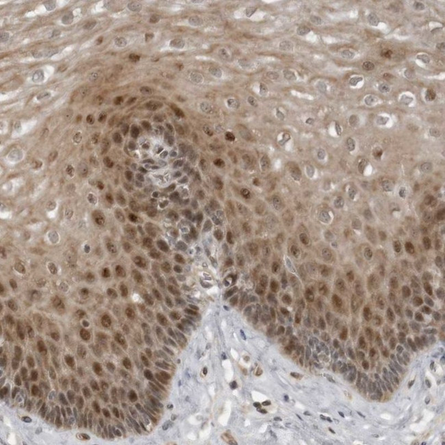 PRRX2 Antibody in Immunohistochemistry (IHC)