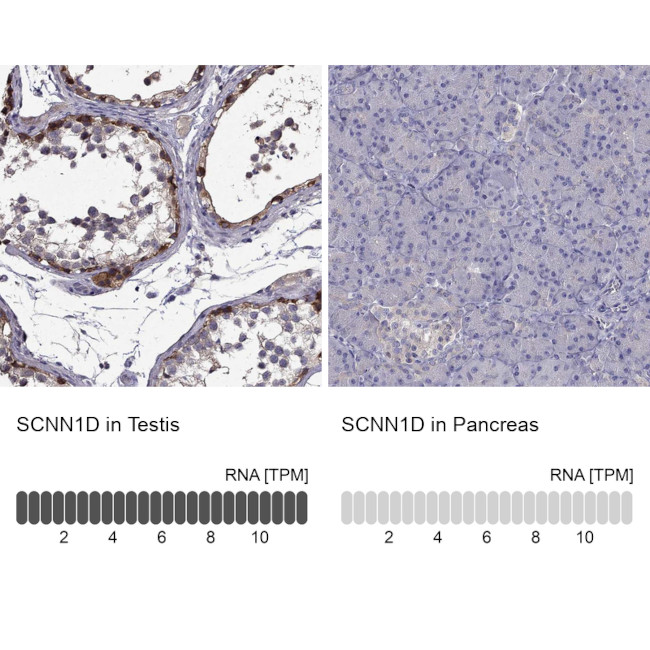 SCNN1D Antibody in Immunohistochemistry (IHC)