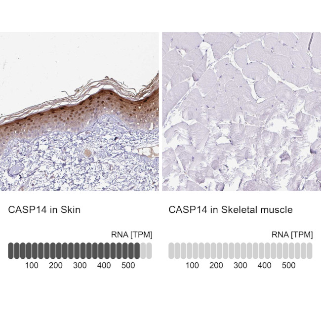 Caspase 14 Antibody