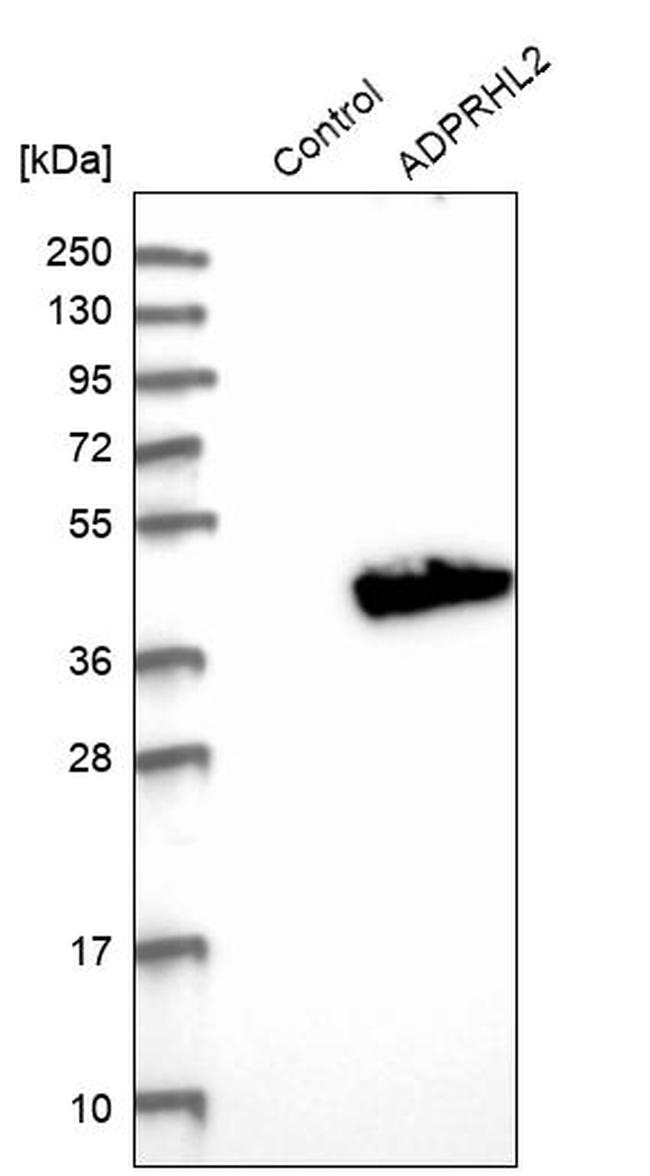 ADPRHL2 Antibody in Western Blot (WB)