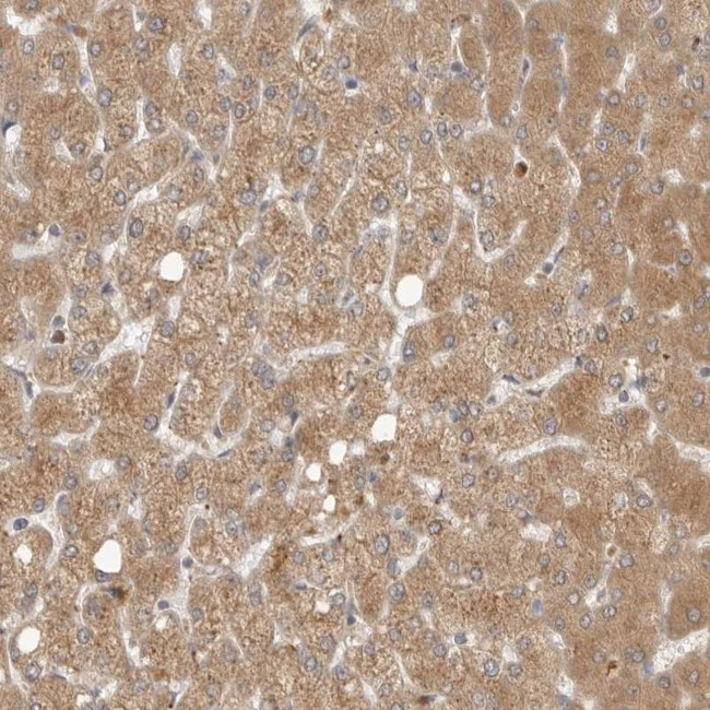 GNE Antibody in Immunohistochemistry (IHC)