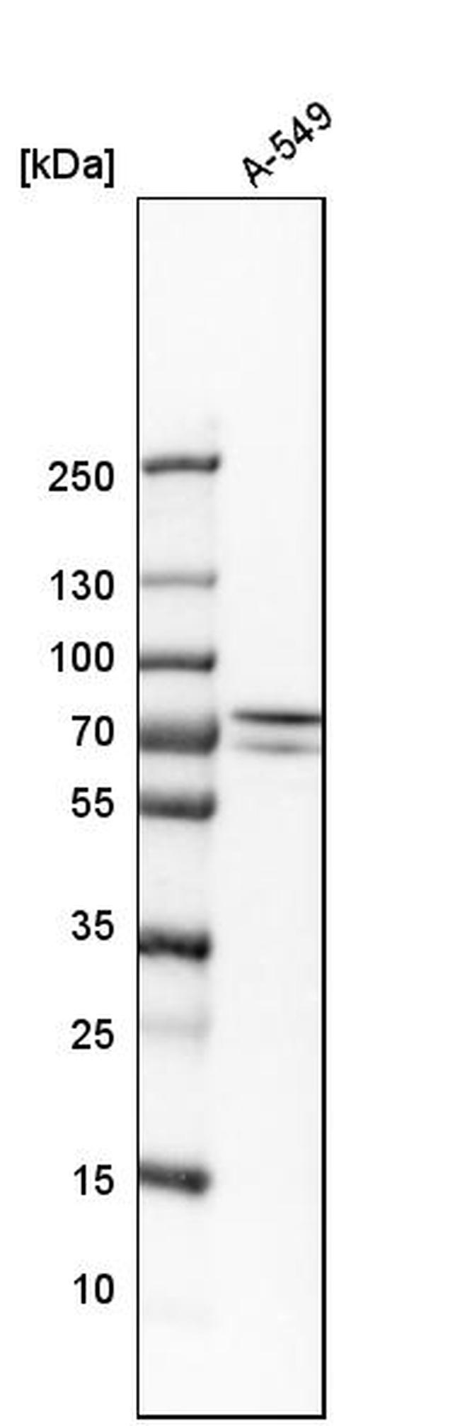 GNE Antibody in Western Blot (WB)