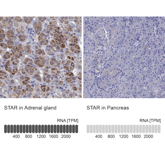 STAR Antibody in Immunohistochemistry (IHC)