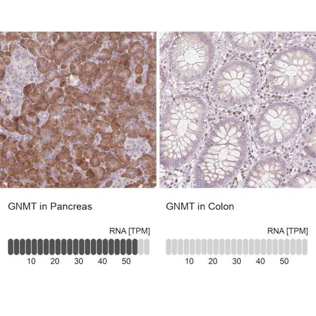 GNMT Antibody in Immunohistochemistry (IHC)