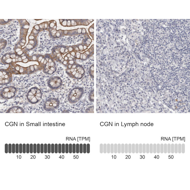 CGN Antibody in Immunohistochemistry (IHC)