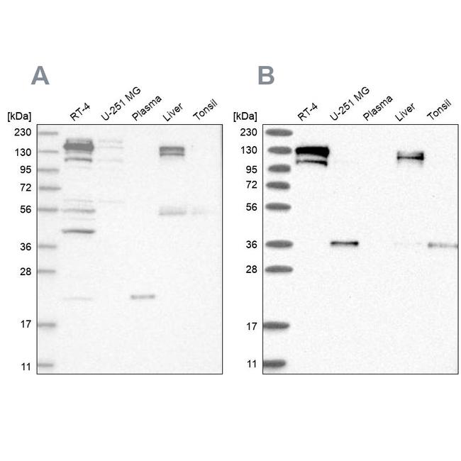 CGN Antibody in Western Blot (WB)