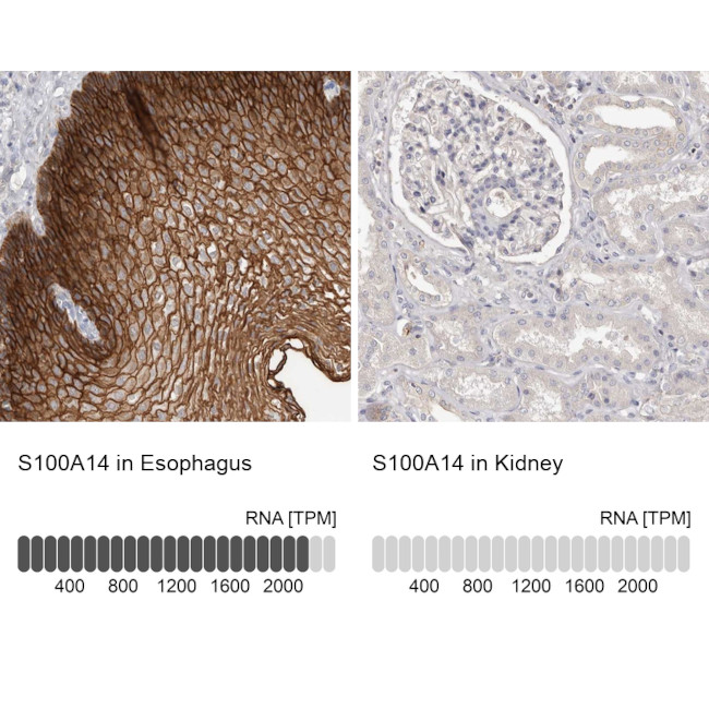 S100A14 Antibody in Immunohistochemistry (IHC)