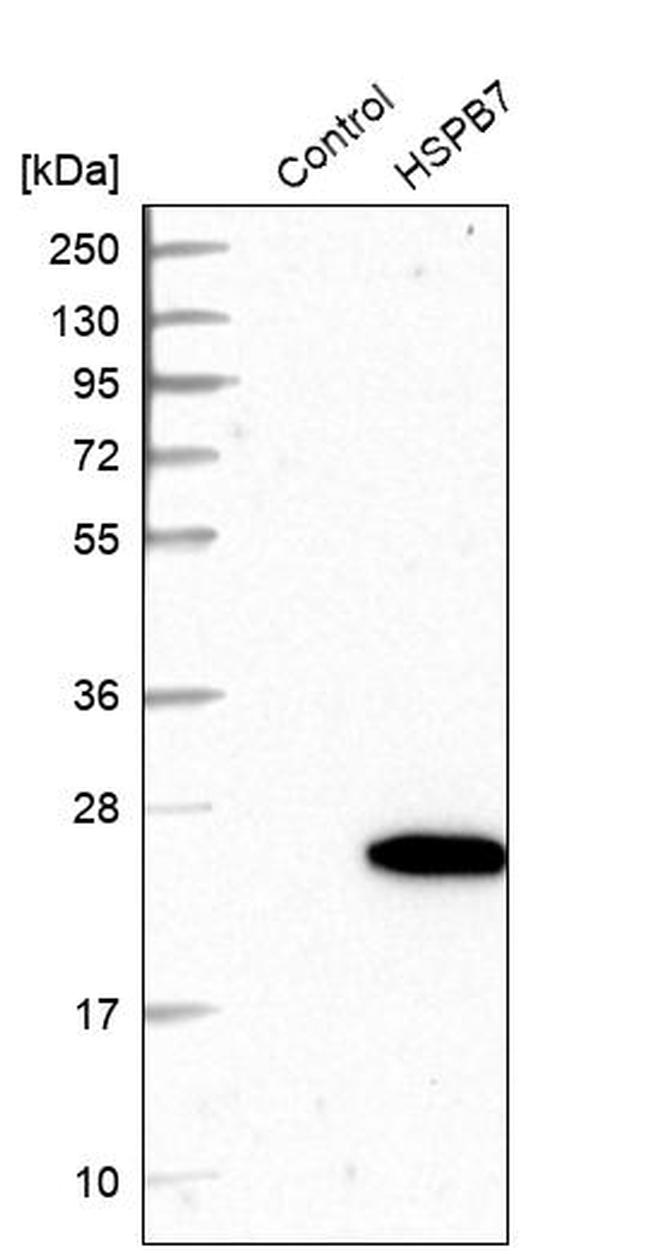 HSPB7 Antibody in Western Blot (WB)