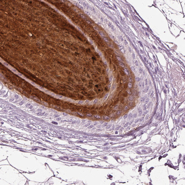 PRR9 Antibody in Immunohistochemistry (IHC)