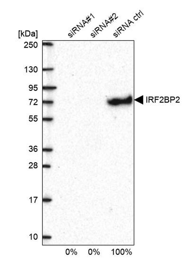 IRF2BP2 Antibody in Western Blot (WB)