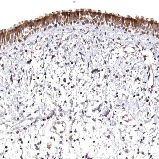 FAM91A1 Antibody in Immunohistochemistry (IHC)