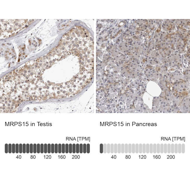 MRPS15 Antibody in Immunohistochemistry (IHC)