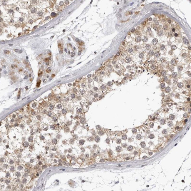 MRPS15 Antibody in Immunohistochemistry (IHC)