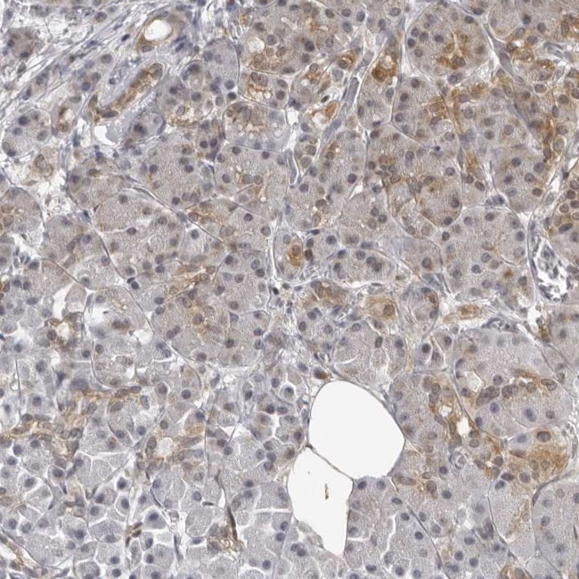 MRPS15 Antibody in Immunohistochemistry (IHC)