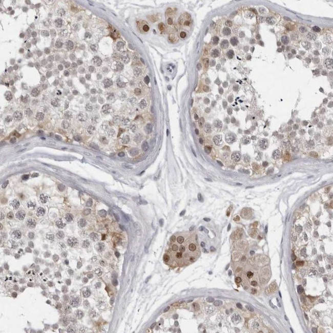 LZIC Antibody in Immunohistochemistry (IHC)