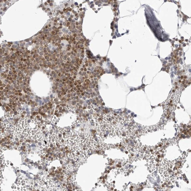 FMNL1 Antibody in Immunohistochemistry (IHC)