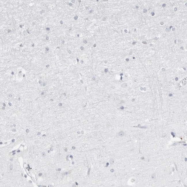 FMNL1 Antibody in Immunohistochemistry (IHC)