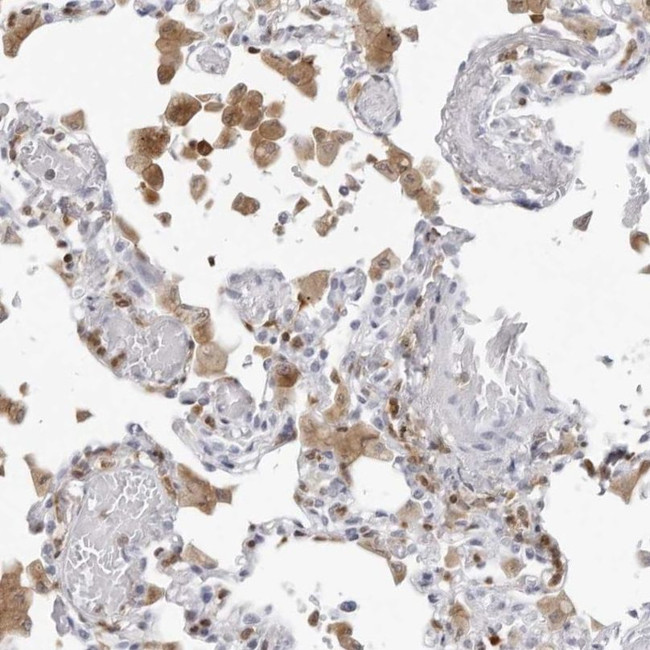 FMNL1 Antibody in Immunohistochemistry (IHC)