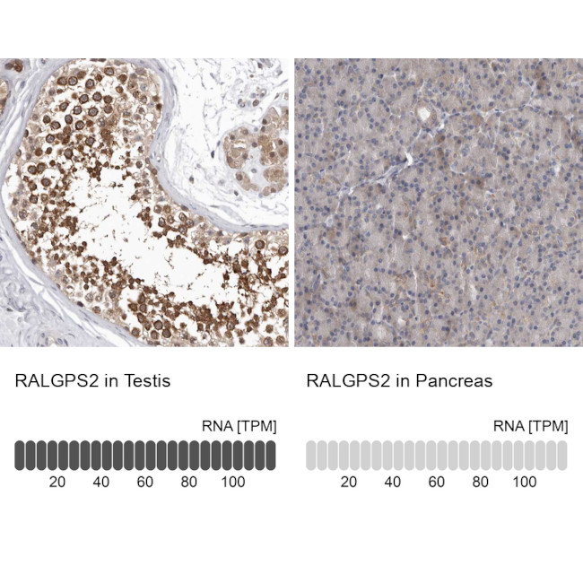 RALGPS2 Antibody in Immunohistochemistry (IHC)