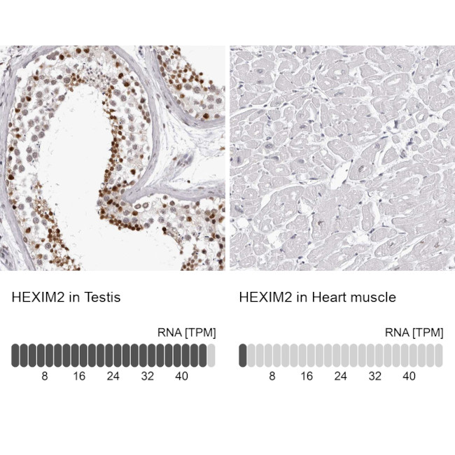 HEXIM2 Antibody in Immunohistochemistry (IHC)