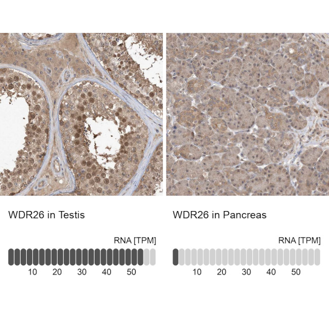 WDR26 Antibody in Immunohistochemistry (IHC)