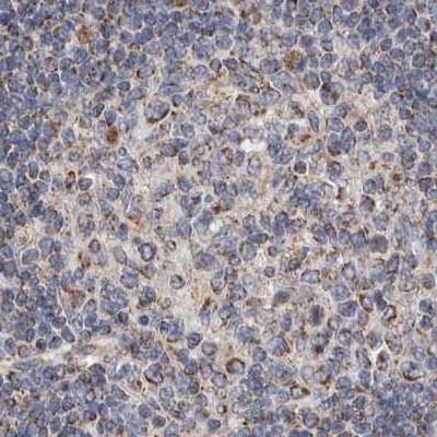 MRPL18 Antibody in Immunohistochemistry (IHC)