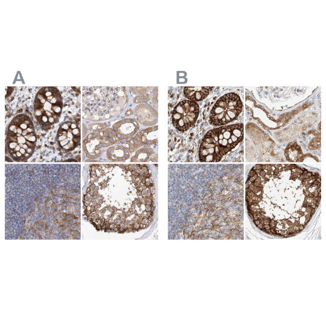 LRRC16A Antibody in Immunohistochemistry (IHC)