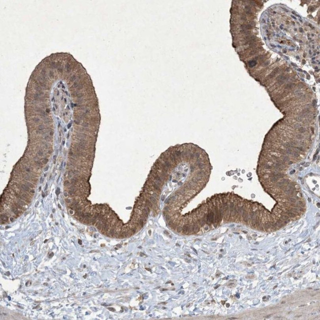 NRBP2 Antibody in Immunohistochemistry (IHC)