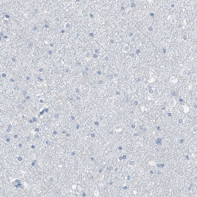 RGN Antibody in Immunohistochemistry (IHC)