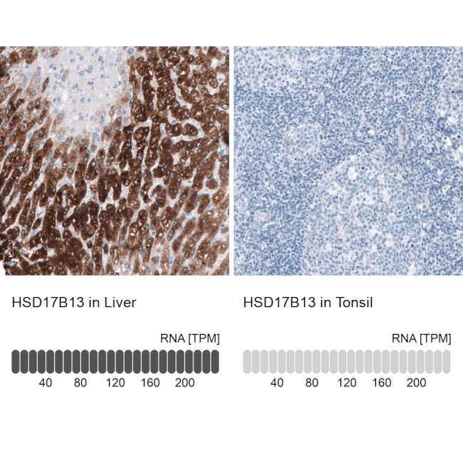 HSD17B13 Antibody in Immunohistochemistry (IHC)