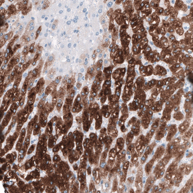 HSD17B13 Antibody in Immunohistochemistry (IHC)