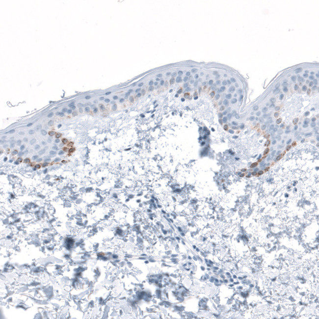 HSD17B13 Antibody in Immunohistochemistry (IHC)