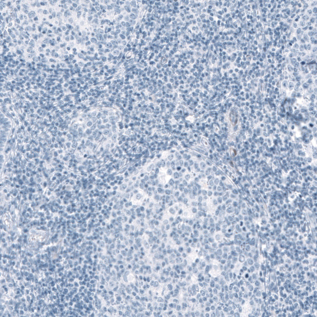 HSD17B13 Antibody in Immunohistochemistry (IHC)