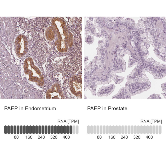 PAEP Antibody in Immunohistochemistry (IHC)