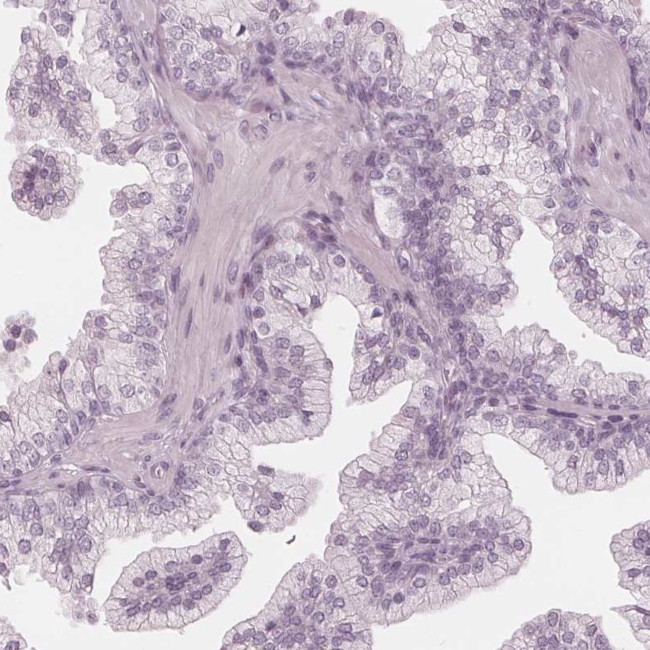 PAEP Antibody in Immunohistochemistry (IHC)