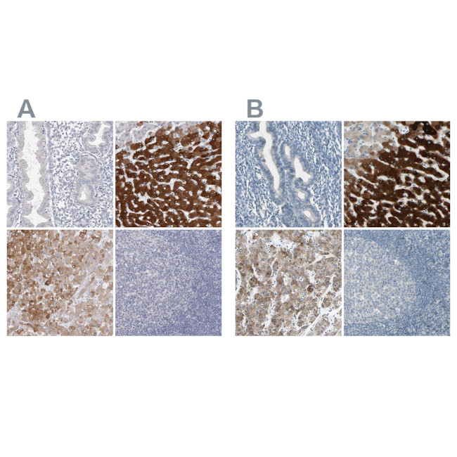 CYP2E1 Antibody in Immunohistochemistry (IHC)