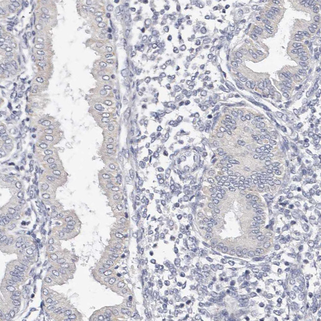 CYP2E1 Antibody in Immunohistochemistry (IHC)