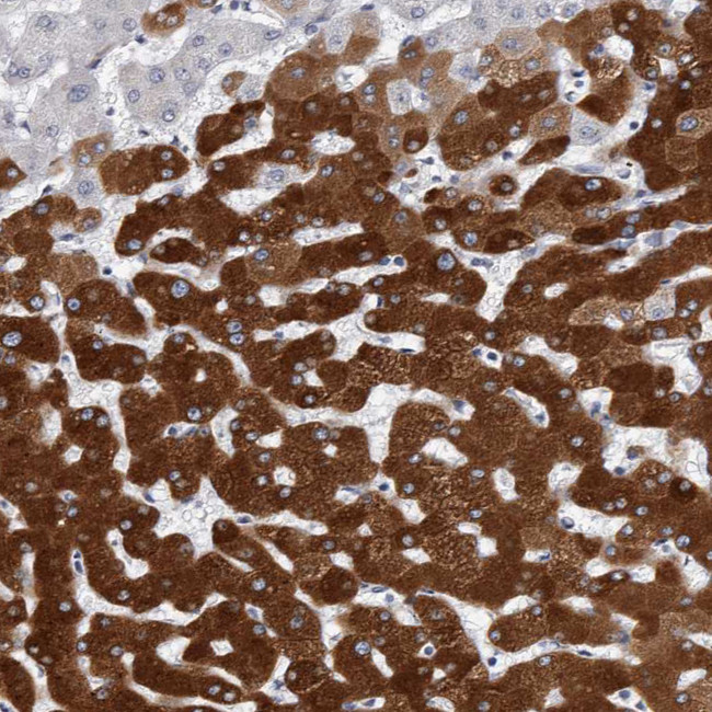 CYP2E1 Antibody in Immunohistochemistry (IHC)