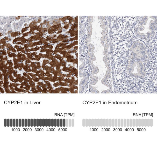 CYP2E1 Antibody