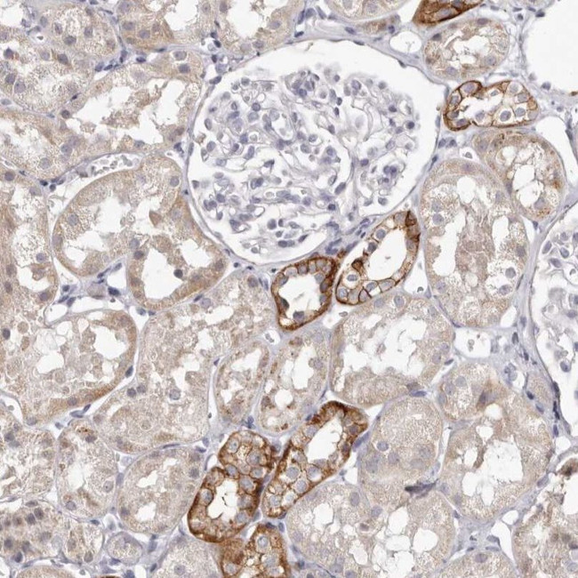 PCDHB6 Antibody in Immunohistochemistry (IHC)