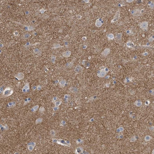 PCLO Antibody in Immunohistochemistry (IHC)