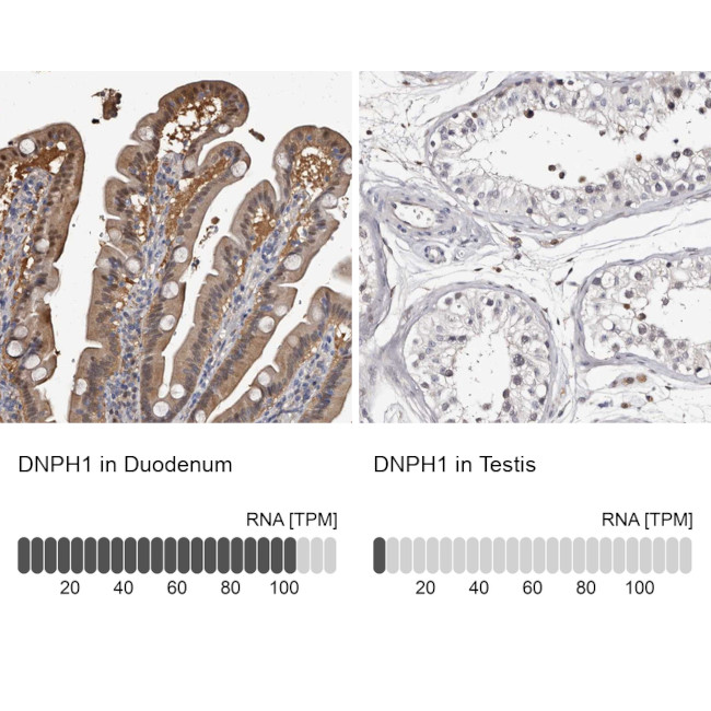 RCL Antibody in Immunohistochemistry (IHC)