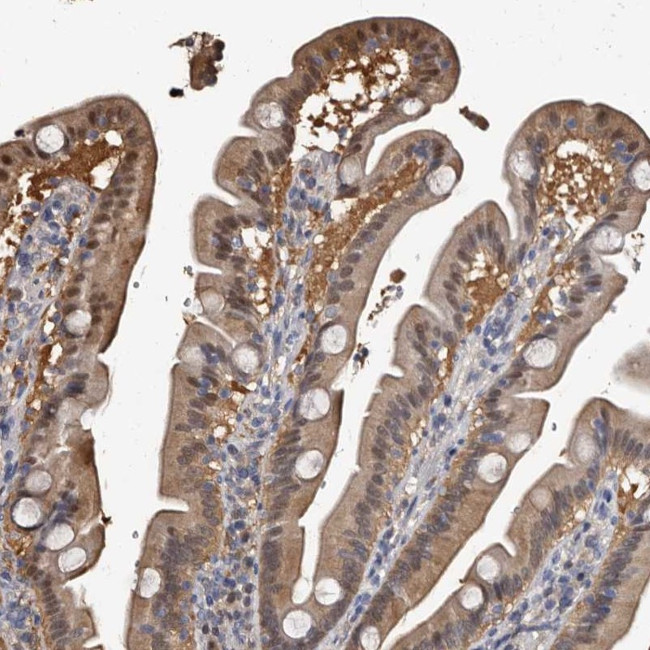 RCL Antibody in Immunohistochemistry (IHC)