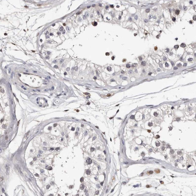 RCL Antibody in Immunohistochemistry (IHC)